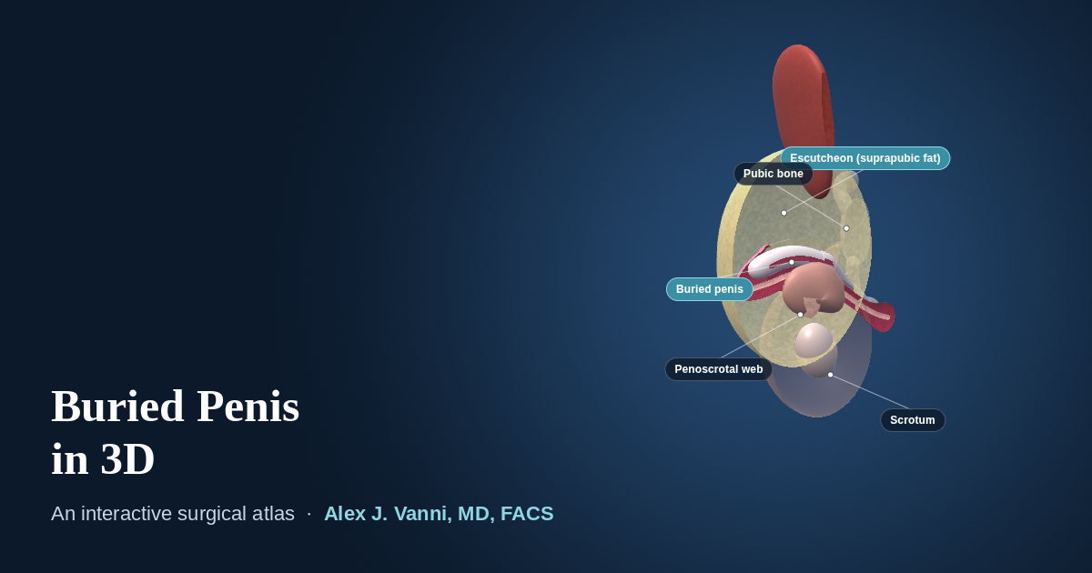 3D cutaway model showing the penis hidden within a thick suprapubic fat pad