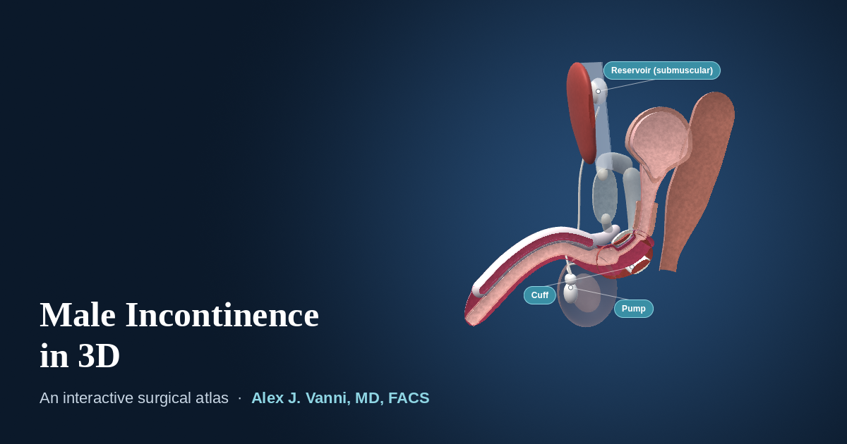 3D model of the male pelvis with an artificial urinary sphincter cuff, pump and reservoir